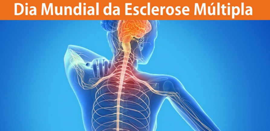 No momento, você está visualizando Dia Mundial da Esclerose Múltipla – 30 de Maio