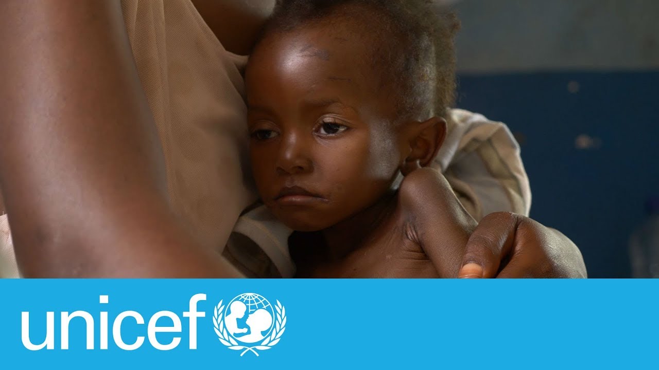 No momento, você está visualizando UNICEF: Aumentam as crianças com desnutrição e com sobrepeso