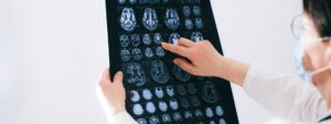 Leia mais sobre o artigo Cientistas criam primeiro atlas do cérebro humano com detalhes