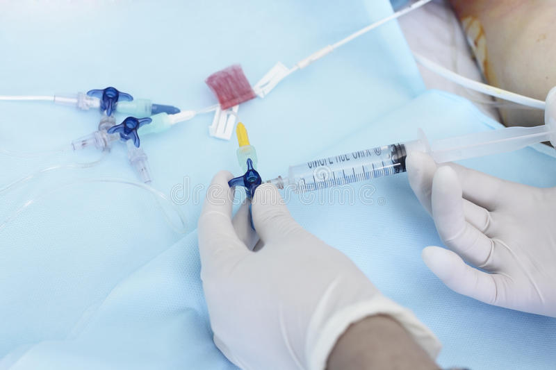 No momento, você está visualizando Decreto zera PIS/Cofins para cateteres intravenosos