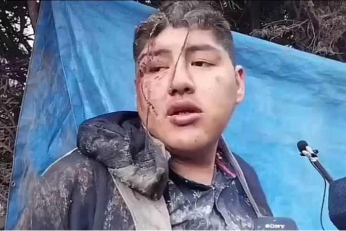No momento, você está visualizando BOLÍVIA: Homem é enterrado vivo após beber e desmaiar