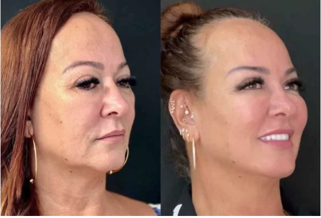 No momento, você está visualizando Especialista explica procedimentos de mãe de Neymar