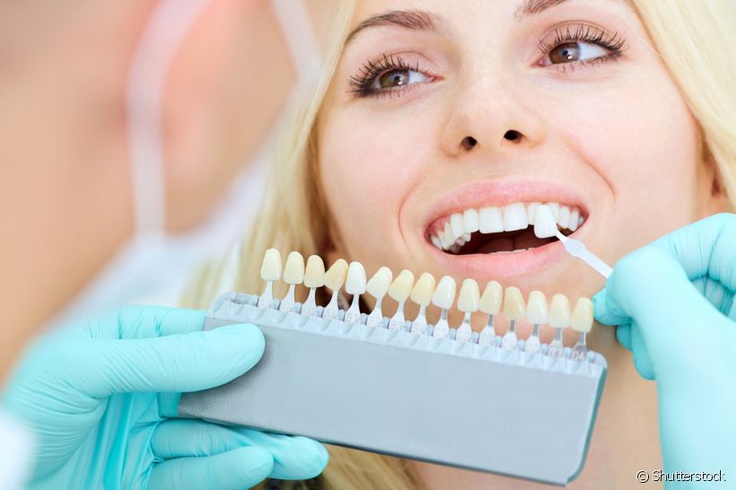 No momento, você está visualizando LENTES NOS DENTES: 5 verdades que você provavelmente não sabe 