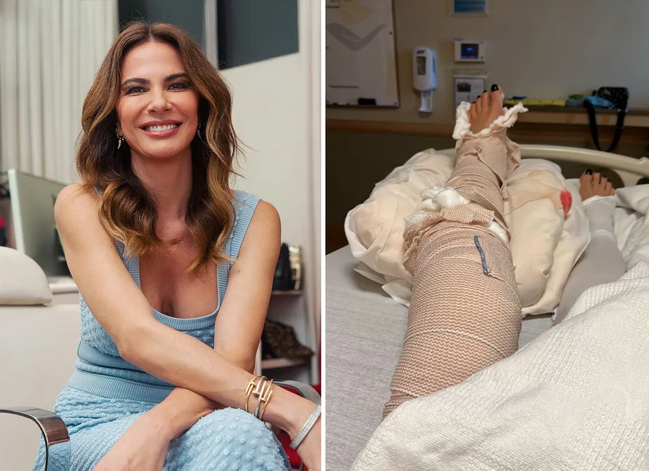 No momento, você está visualizando Após cirurgia às pressas, Luciana Gimenez mostra perna quebrada