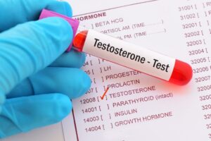 Leia mais sobre o artigo JANEIRO BRANCO: Testosterona baixa pode causar depressão?