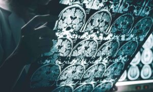 Leia mais sobre o artigo Estudo revela sinal precoce de Alzheimer