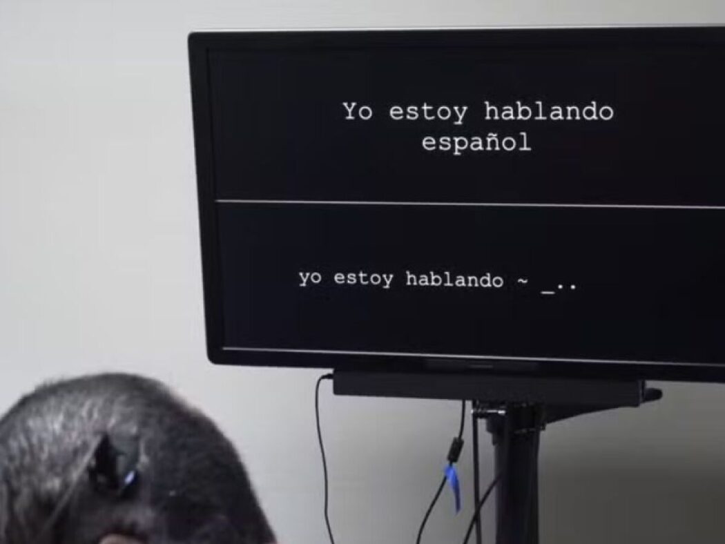 No momento, você está visualizando Implante cerebral bilíngue permite paciente falar dois idiomas pela primeira vez