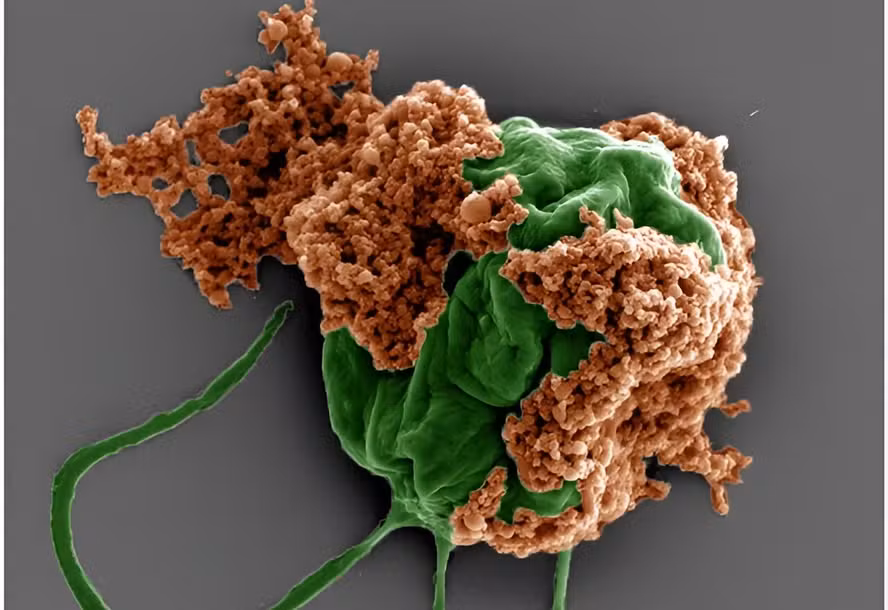 No momento, você está visualizando Cientistas testam microrrobô que viaja pelo pulmão e combate câncer