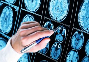 Leia mais sobre o artigo Saiba como é o primeiro chip para epilepsia do mundo