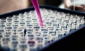 Leia mais sobre o artigo Estudo mostra que inflamação no cérebro pode ser chave do Alzheimer