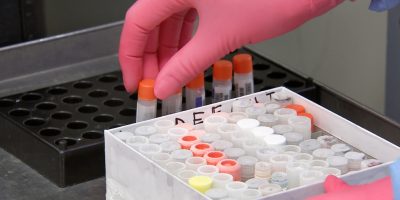 EBOLA: Reino Unido inicia testes em humanos de vacina