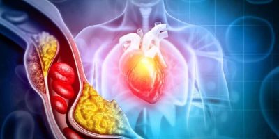 edicao-genetica-reduz-niveis-colesterol-ldl